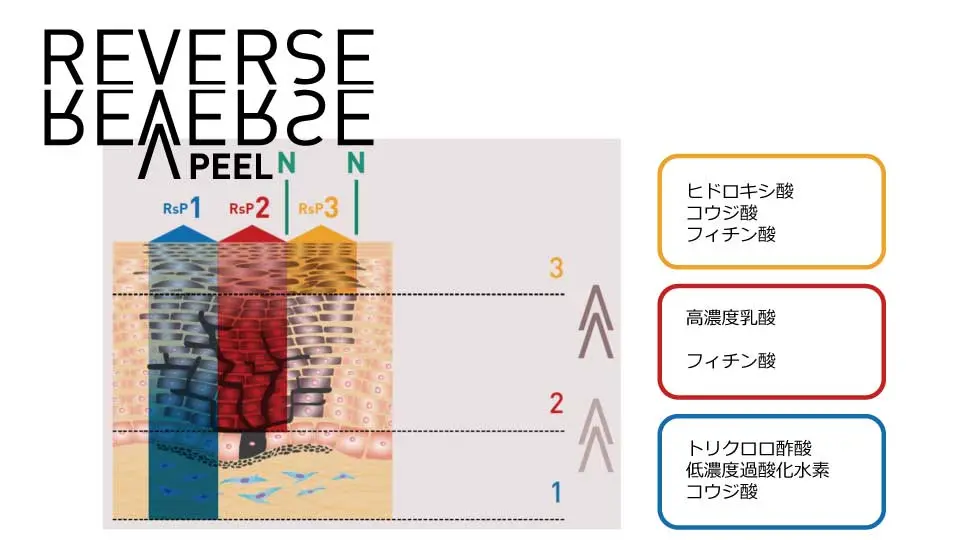 リバースピール