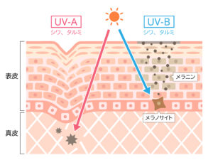 UBAとUVBの違いの図解